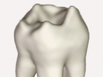 Мъдрец, умник, хитър зъб