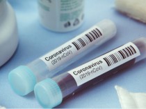 Започнаха тестовете на футболисти в Премиършип