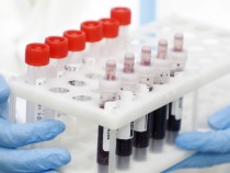 10 от Миньор вече са с отрицателен тест за Covid-19