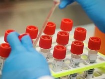 Ето каква ще е цената на американската ваксина срещу COVID-19