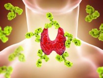 Фармаколог: Болестта на Хашимото не е присъда