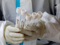 22-ма са заразените от КОВИД-19 в Босилеград за последния месец