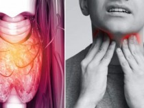 10 признака за рак на гърлото, които не трябва да се игнорират