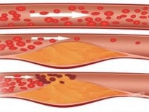 Никой не подозира, но тези популярни плодове смъкват холестерола