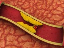 Австралийски учени: Хапвайте това и няма да имате болести на кръвоносните съдове