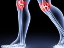 Има растение, което ще ви избави от болките в ставите