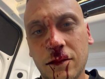 Пребиха брутално известния активист срещу протестите Георги Флоров СНИМКИ 18+