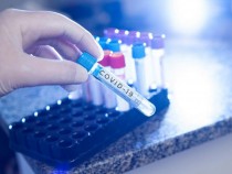 Учени посочиха необратимите последици от прекаран К-19