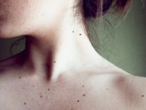 Професор посочи бенките на кои места са най-опасни за здравето