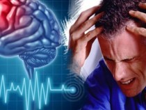 Какви тревожни сигнали ни праща тялото преди инсулт