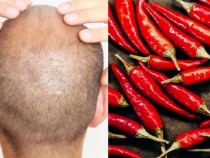 Лук или люти чушки срещу косопад, наистина ли помагат