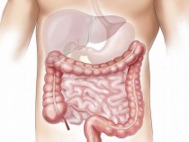 Онколози посочиха един от най-явните симптоми за рак на червата