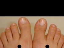 5 начина да спрем ужасното главоболие!