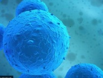 Учени от Imperial College London: Трансплантация на стволови клетки може да &bdquo;замрази&ldquo; множествената склероза