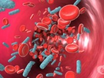 Американски лекар с пробив в борбата с коварна болест на кръвта