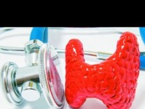 Хашимото често се случва, без симптоми и причини за много проблеми. Кога за последен път проверихте хормоните на щитовидната жлеза